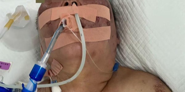 被前夫打进ICU的女子情况仍不稳定，其8岁女儿也曾遭父亲扇脸，律师：已构成故意伤害罪，或同时涉虐待罪